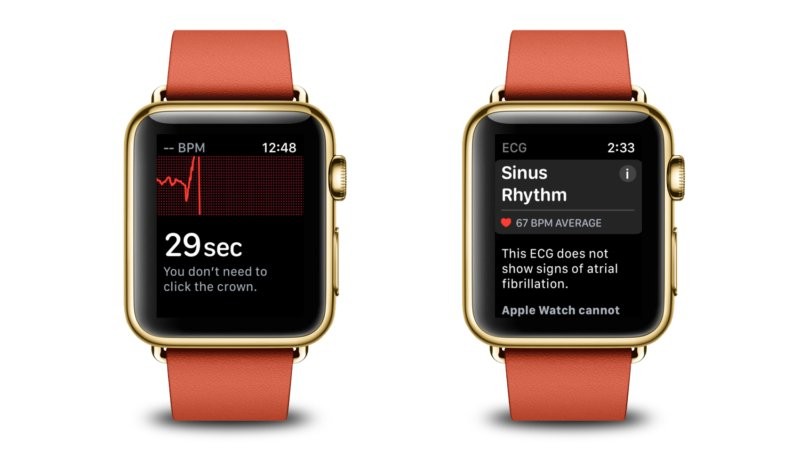 Apple Watch EKG-sovellus