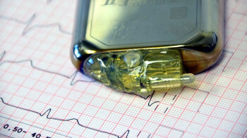 Gardez ces appareils Apple loin de votre pacemaker