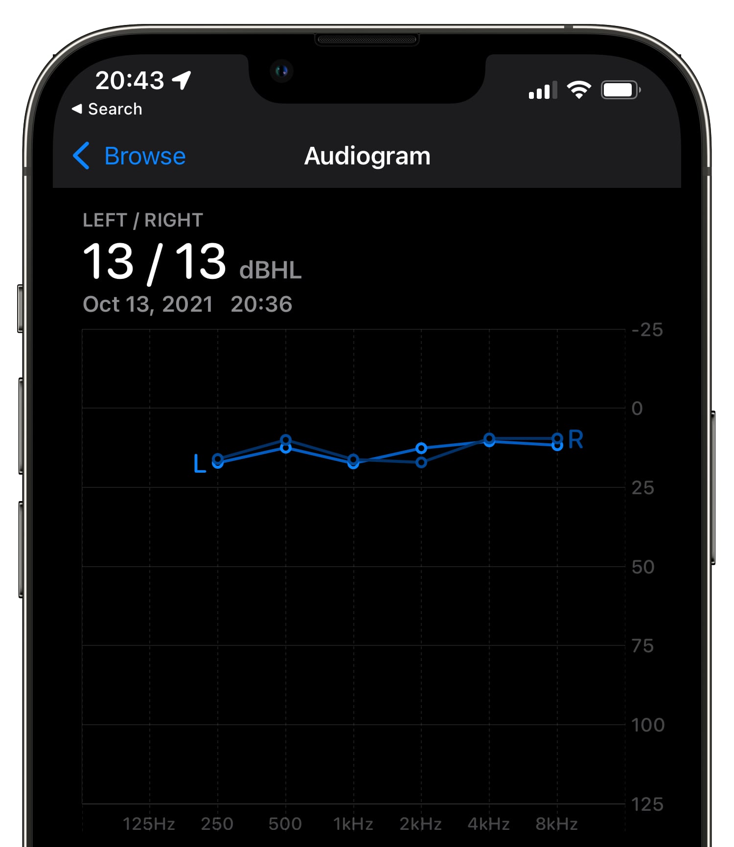 Сделать аудиограмму в спб. Аудиограмма слуха. Audiogram.