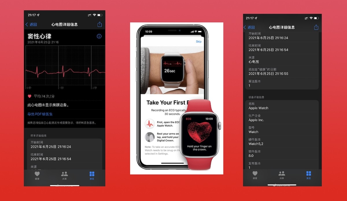 ecg-apple-watch